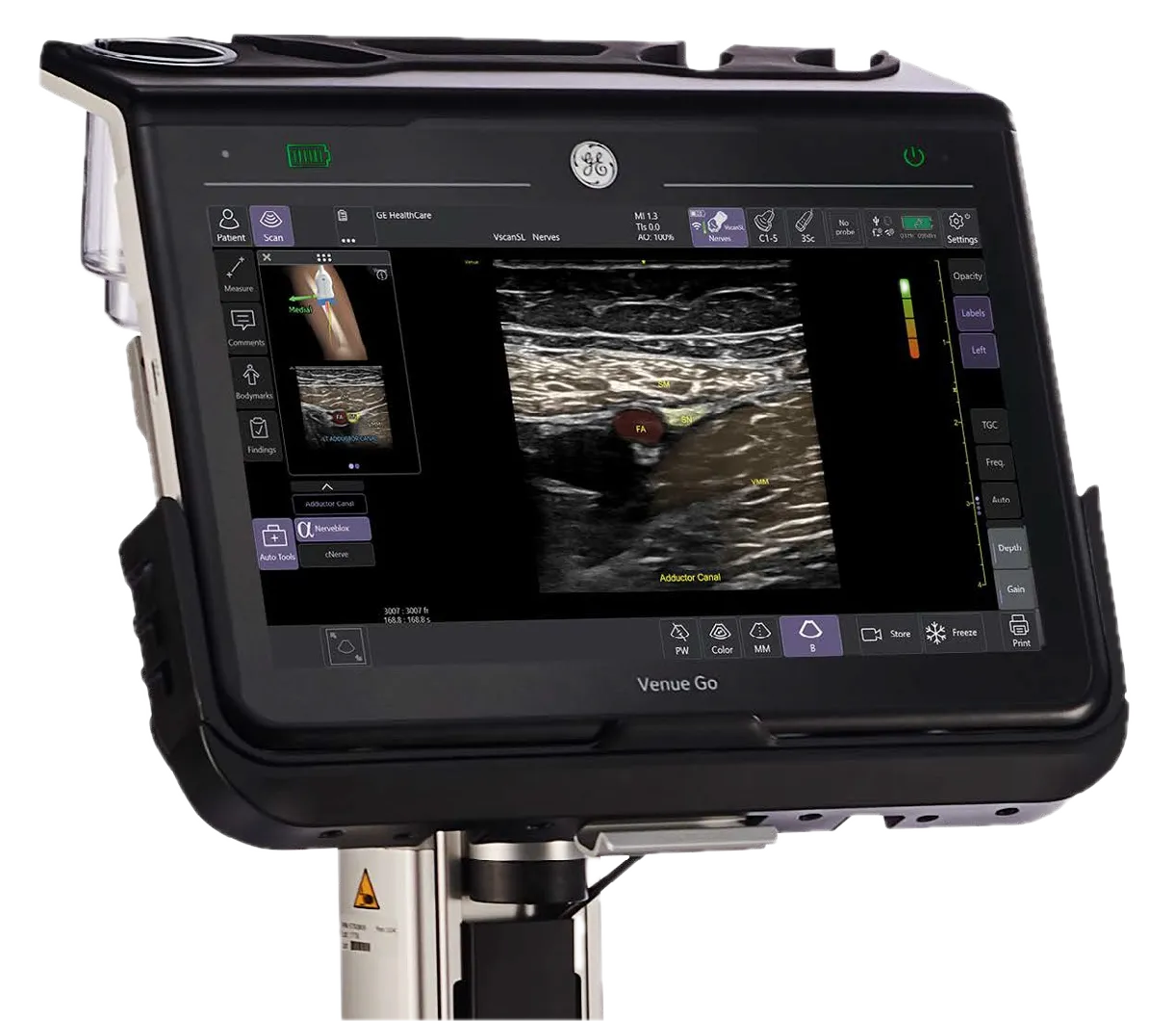 Nerveblox running on a GE HealthCare ultrasound system