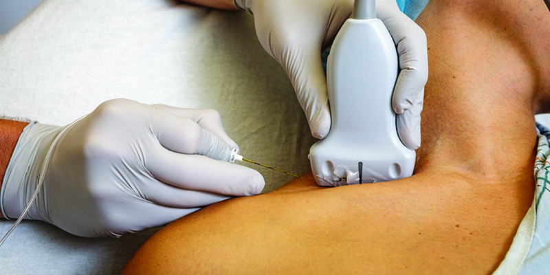 Ultrasound & Peripheral Nerve Blocks